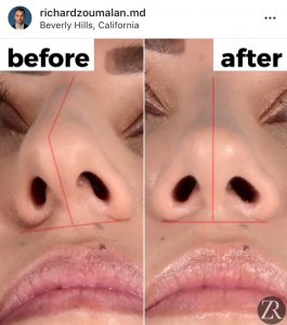 improving your plastic surgery instagram content